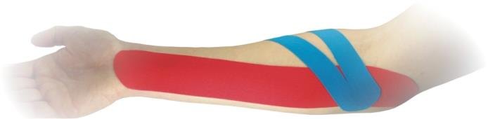 Fink & Walter FIWA®kin – Elastischer Tape-Verband 5cm x 5m, BLAU, Pckg. à 12 Stück zur kinesiologischen Therapie / 12 St. (REF 1672211)